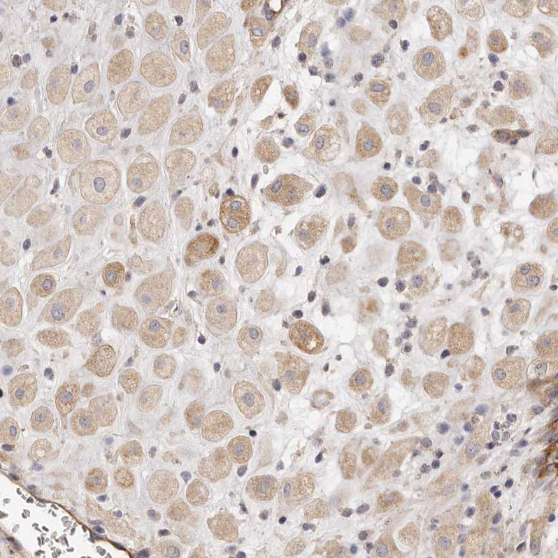 Immunohistochemical staining of human placenta shows moderate cytoplasmic positivity in decidual cells.