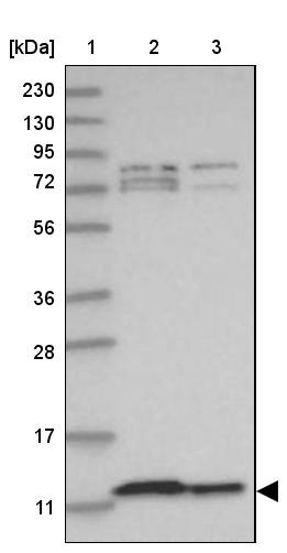 Lane 1: Marker [kDa] 230, 130, 95, 72, 56, 36, 28, 17, 11<br/>Lane 2: Human cell line RT-4<br/>Lane 3: Human cell line U-251MG sp