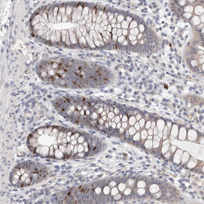 Immunohistochemical staining of human colon shows nuclear positivity in a fraction of basal glandular cells.