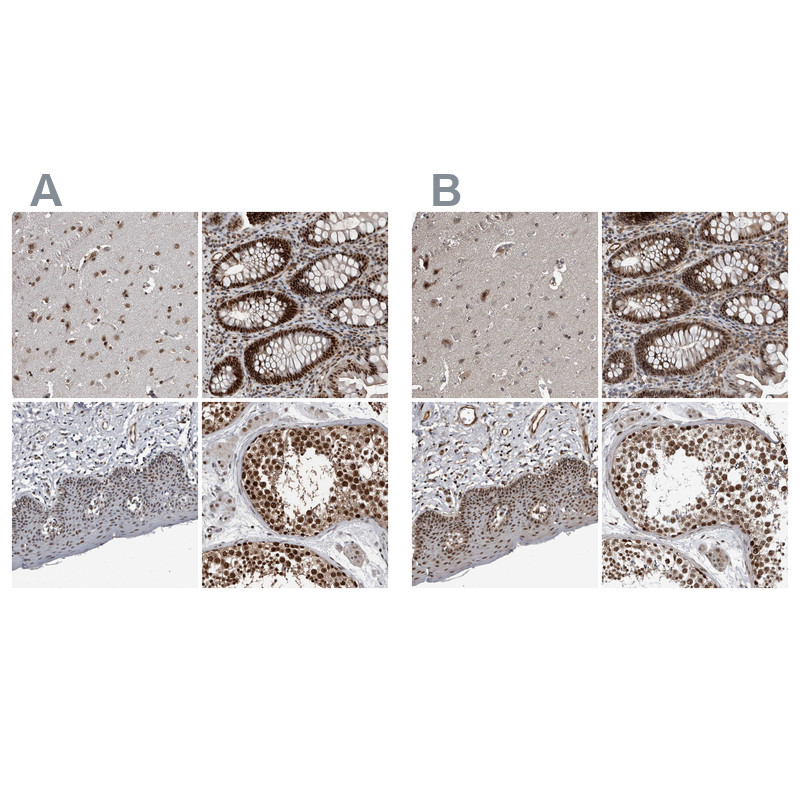 Immunohistochemical staining of human cerebral cortex, lower gastrointestinal, skin and testis using Anti-CHD1L antibody HPA028670 (A) shows similar protein distribution across tissues to independent antibody HPA027789 (B).