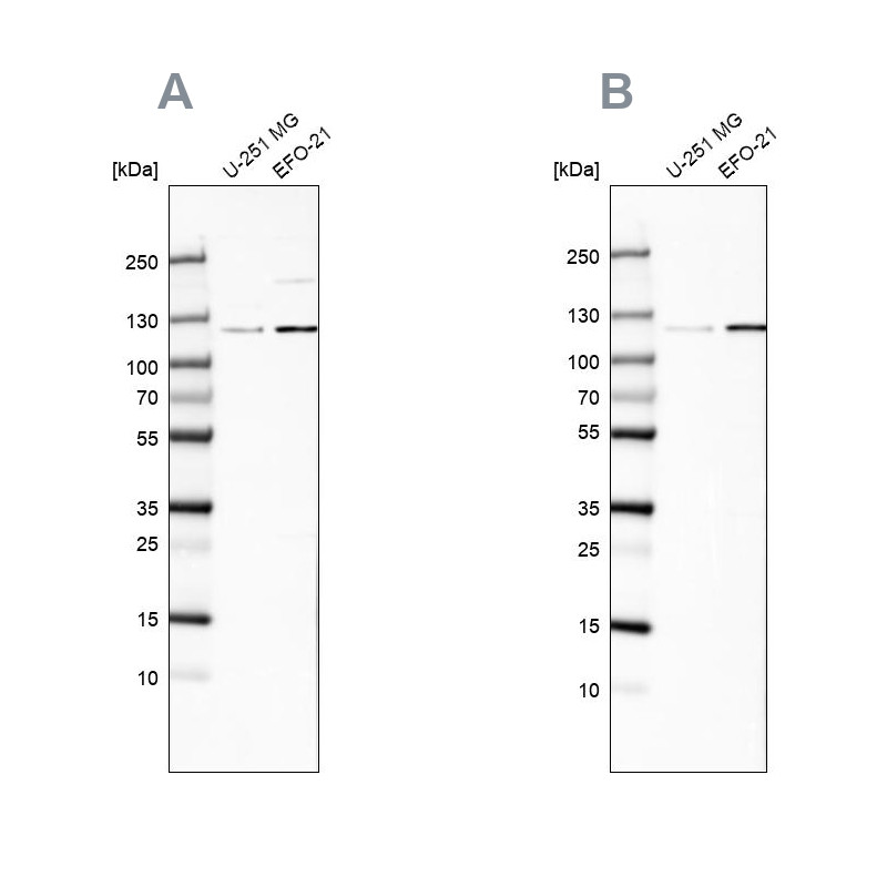 Western blot analysis using Anti-CHD1L antibody HPA028670 (A) shows similar pattern to independent antibody HPA027789 (B).