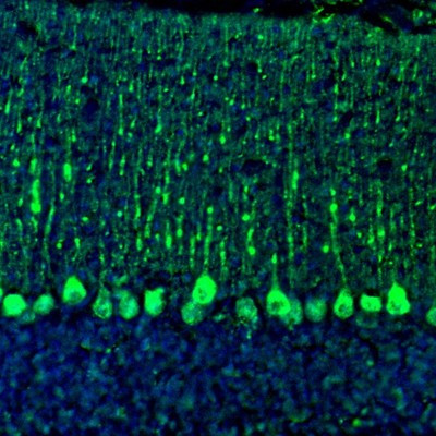 Immunofluorescence staining of mouse cerebellum shows strong immunoreactivity in Purkinje cells.