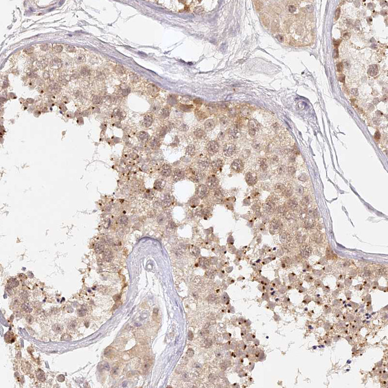 Immunohistochemical staining of human Testis shows moderate nuclear and cytoplasmic positivity in cells in seminiferous ducts.