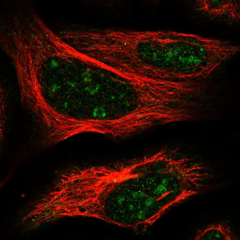 Immunofluorescent staining of human cell line U-2 OS shows localization to nucleoli.
