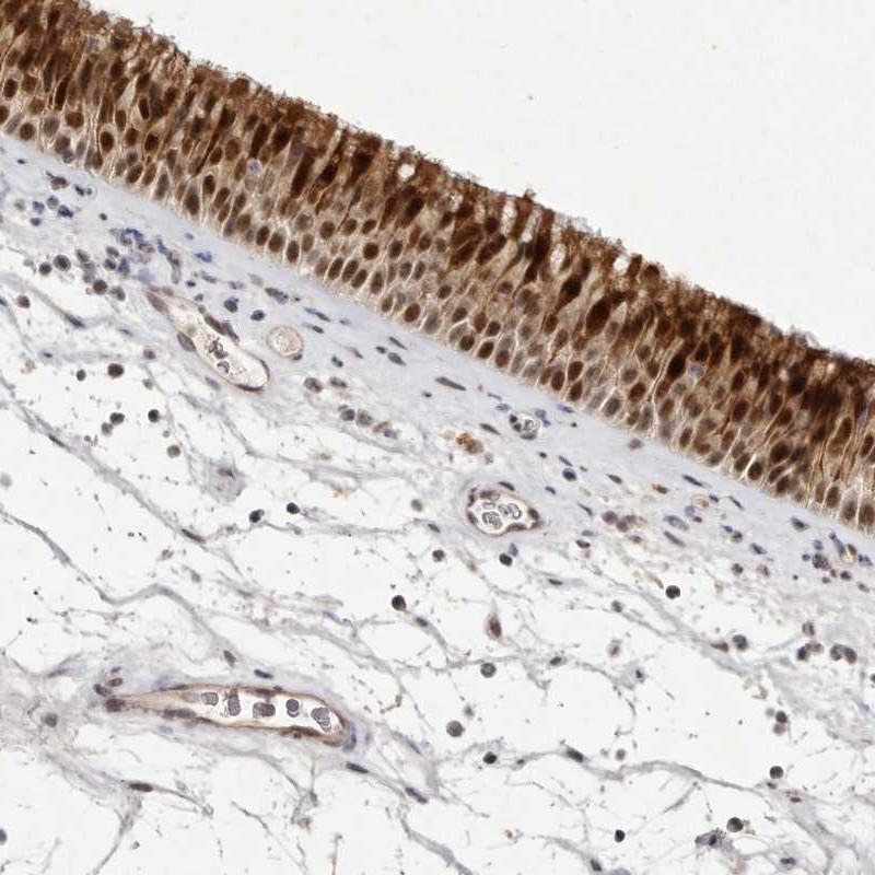 Immunohistochemical staining of human nasopharynx shows strong cytoplasmic and nuclear positivity in respiratory epithelial cells.