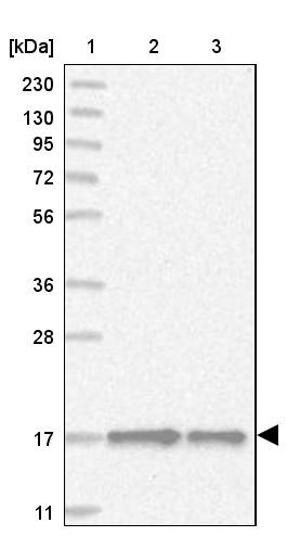 Lane 1: Marker [kDa] 230, 130, 95, 72, 56, 36, 28, 17, 11<br/>Lane 2: Human cell line RT-4<br/>Lane 3: Human cell line U-251MG sp