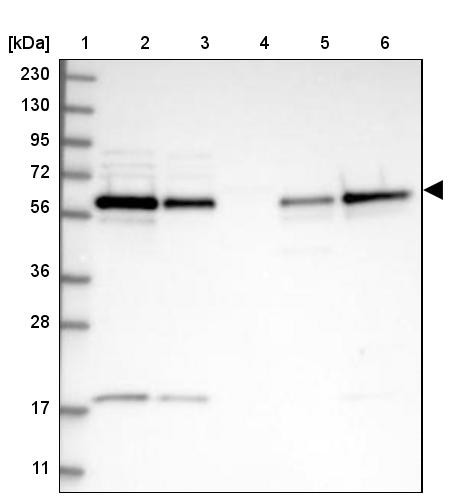 Lane 1: Marker [kDa] 230, 130, 95, 72, 56, 36, 28, 17, 11<br/>Lane 2: Human cell line RT-4<br/>Lane 3: Human cell line U-251 MG<br/>Lane 4: Human plasma<br/>Lane 5: Human Liver tissue<br/>Lane 6: Human Tonsil tissue