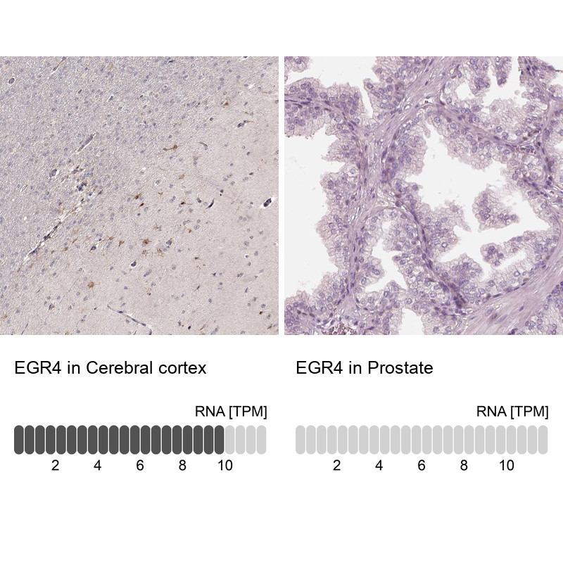 Immunohistochemistry analysis in human cerebral cortex and prostate tissues using HPA028983 antibody. Corresponding EGR4 RNA-seq data are presented for the same tissues.