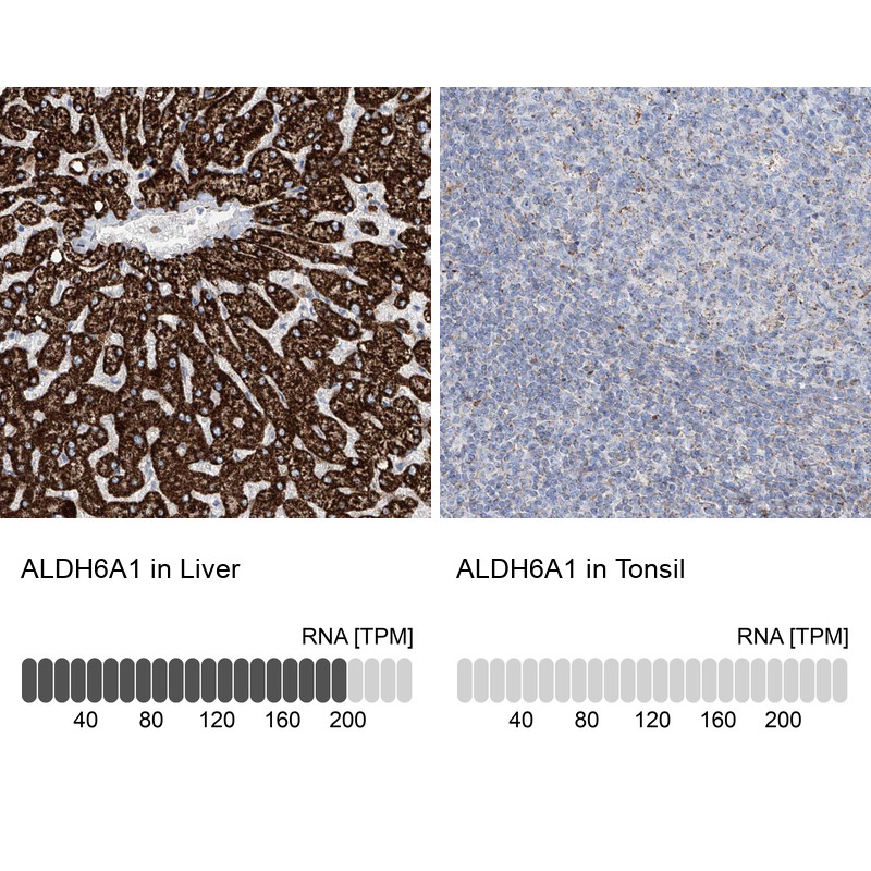 Immunohistochemistry analysis in human liver and tonsil tissues using Anti-ALDH6A1 antibody. Corresponding ALDH6A1 RNA-seq data are presented for the same tissues.
