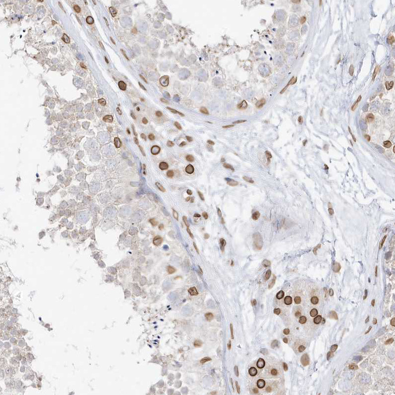 Immunohistochemical staining of human testis shows strong positivity in nuclear membrane in Leydig cells and a subset of cells in seminiferous ducts.