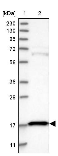 Lane 1: Marker [kDa] 230, 130, 95, 72, 56, 36, 28, 17, 11<br/>Lane 2: Human cell line RT-4