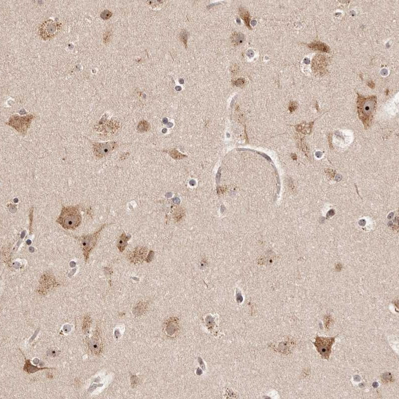Immunohistochemical staining of human cerebral cortex shows strong nucleolar and cytoplasmic positivity in neuronal cells.