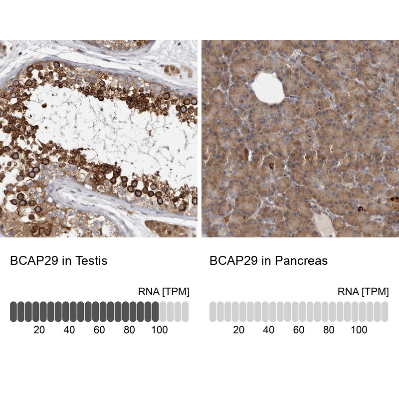Immunohistochemistry analysis in human testis and pancreas tissues using Anti-BCAP29 antibody. Corresponding BCAP29 RNA-seq data are presented for the same tissues.