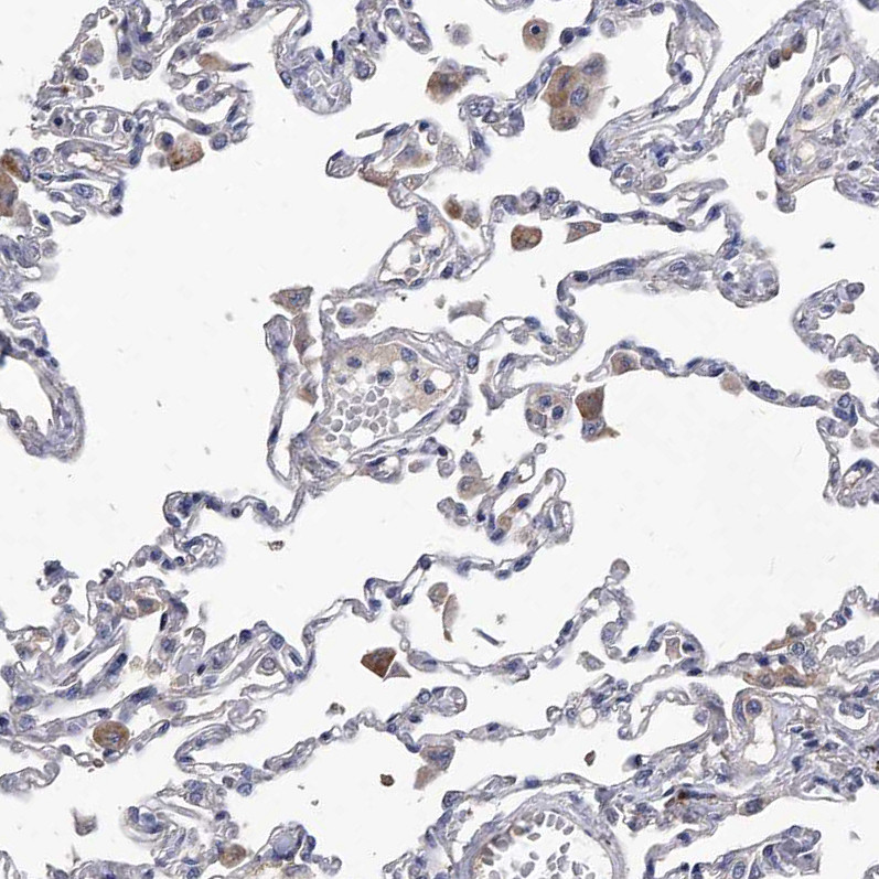Immunohistochemical staining of human lung shows moderate cytoplasmic positivity in macrophages.