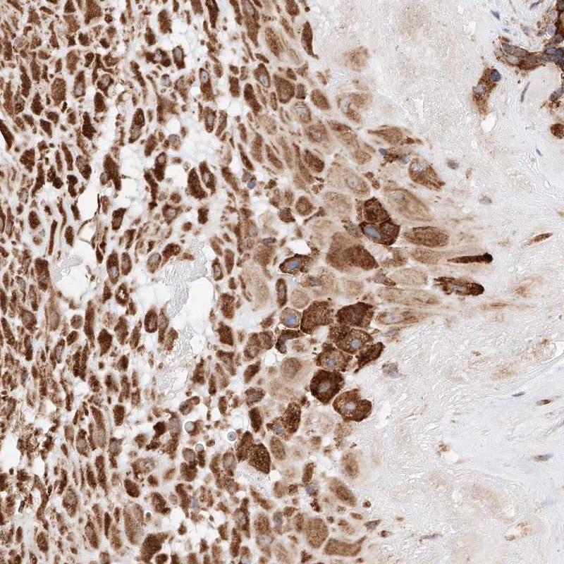 Immunohistochemical staining of human placenta shows strong cytoplasmic positivity in decidual cells.