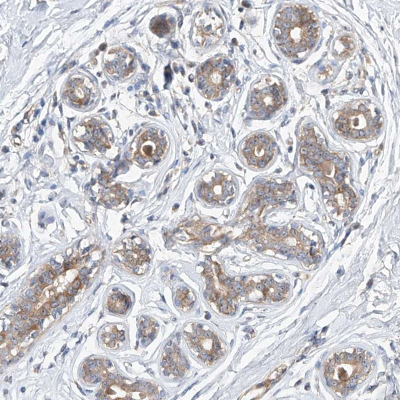 Immunohistochemical staining of human breast shows moderate cytoplasmic positivity in glandular cells.