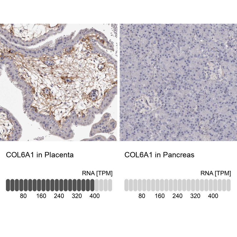 Immunohistochemistry analysis in human placenta and pancreas tissues using HPA029401 antibody. Corresponding COL6A1 RNA-seq data are presented for the same tissues.