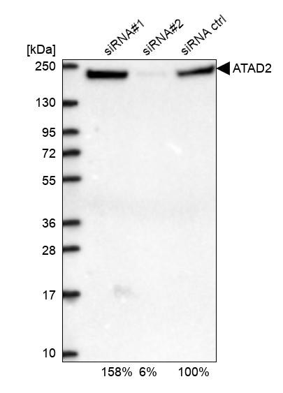 Western blot analysis in U2OS cells transfected with control siRNA, target specific siRNA probe #1 and #2, using Anti-ATAD2 antibody. Remaining relative intensity is presented.