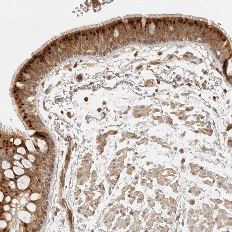 Immunohistochemical staining of human bronchus shows strong cytoplasmic positivity in respiratory epithelial cells.