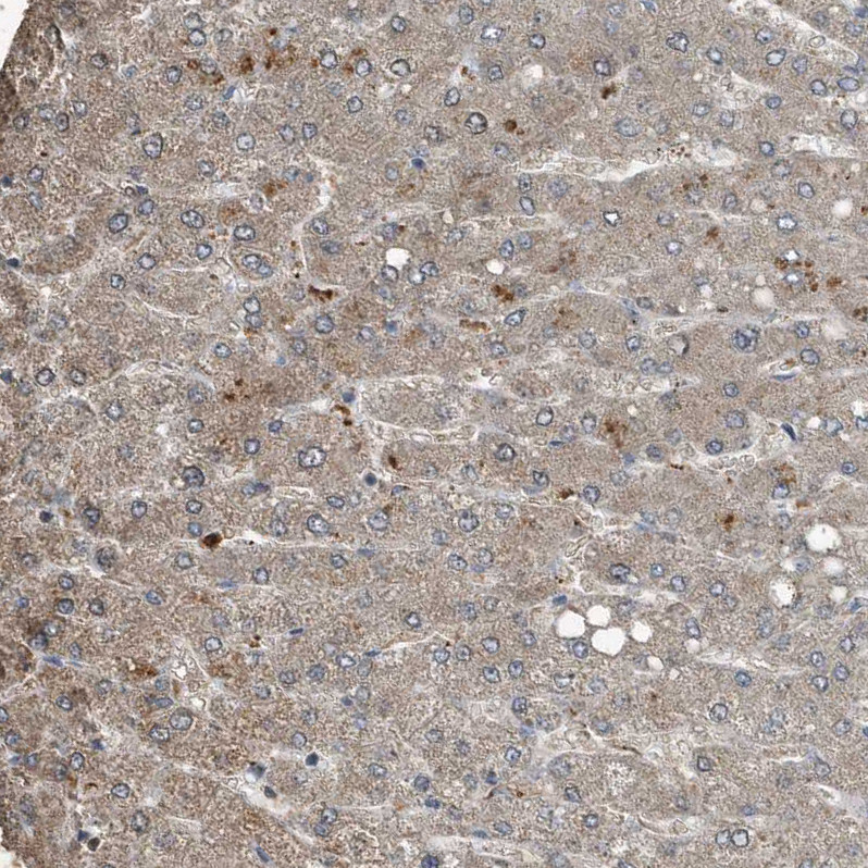 Immunohistochemical staining of human Liver shows moderate cytoplasmic positivity in hepatocytes.