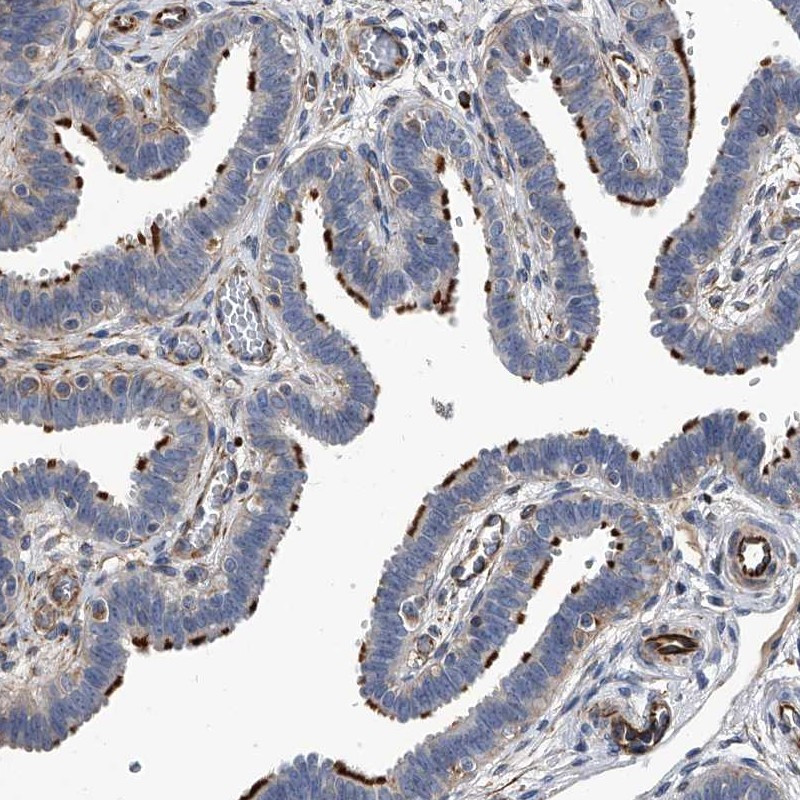 Immunohistochemical staining of human fallopian tube shows strong membranous positivity in glandular cells.