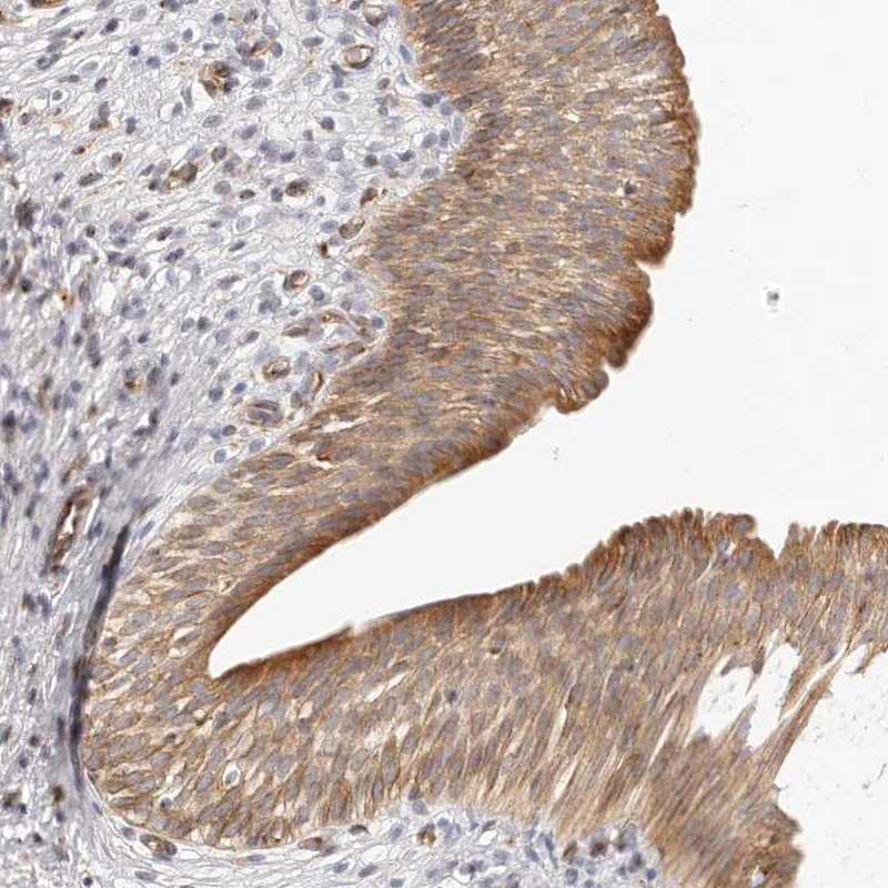 Immunohistochemical staining of human urinary bladder shows moderate cytoplasmic and luminal membrane positivity in urothelial cells.