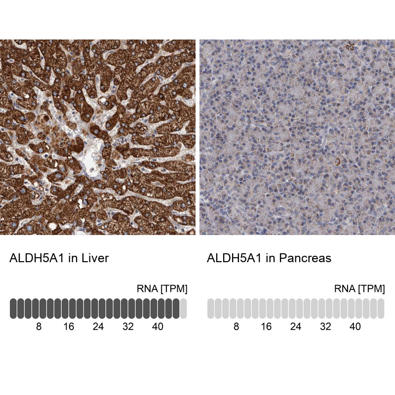 Immunohistochemistry analysis in human liver and pancreas tissues using Anti-ALDH5A1 antibody. Corresponding ALDH5A1 RNA-seq data are presented for the same tissues.