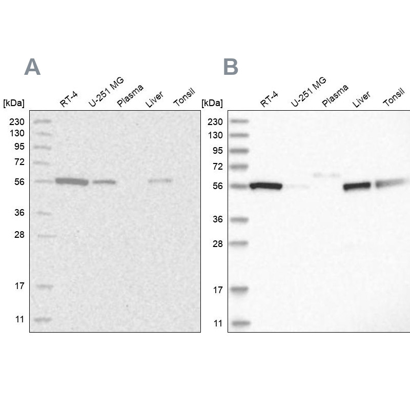 Western blot analysis using Anti-ALDH5A1 antibody HPA029716 (A) shows similar pattern to independent antibody HPA029715 (B).
