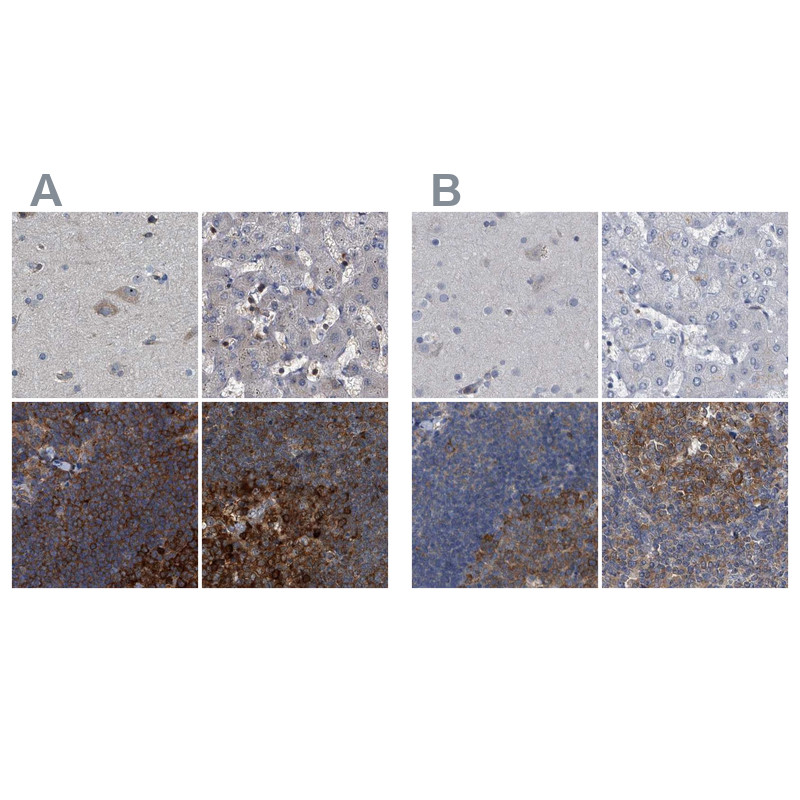 Immunohistochemical staining of human cerebral cortex, liver, lymph node and tonsil using Anti-CDV3 antibody HPA029761 (A) shows similar protein distribution across tissues to independent antibody HPA029762 (B).