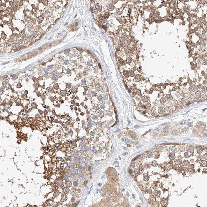 Immunohistochemical staining of human testis shows moderate cytoplasmic positivity in seminiferous ducts.