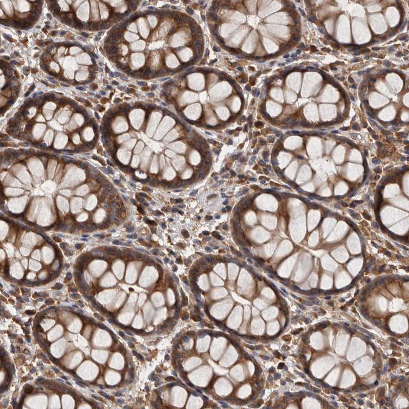 Immunohistochemical staining of human gastrointestinal shows strong cytoplasmic positivity in glandular cells.