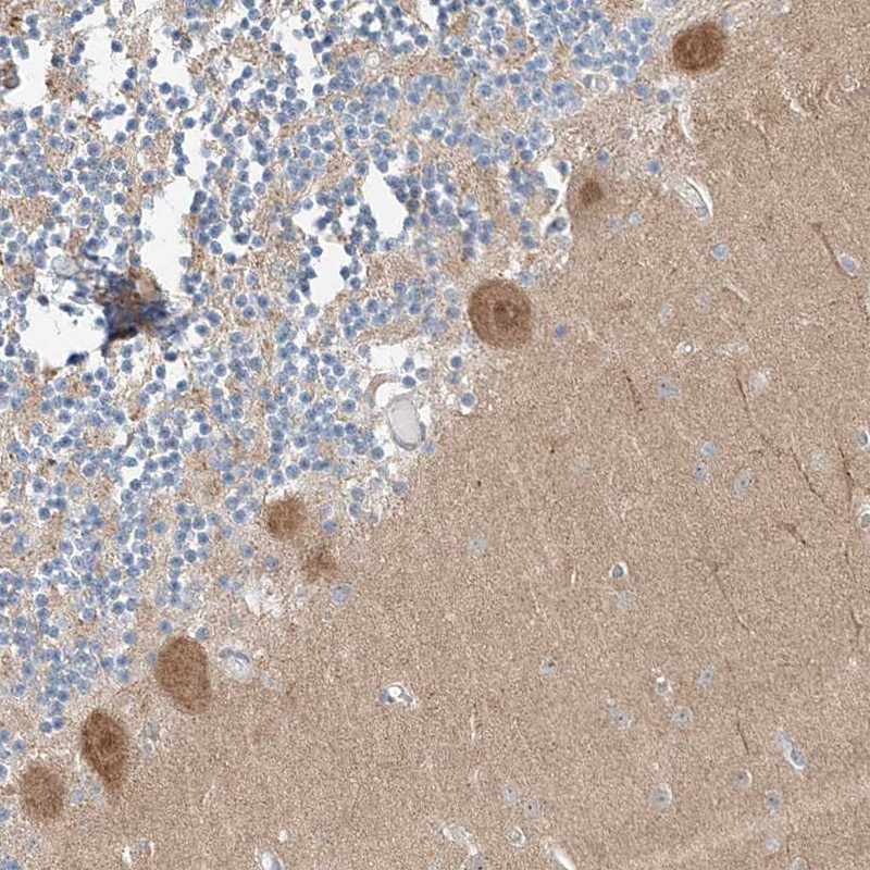 Immunohistochemical staining of human cerebellum shows moderate cytoplasmic positivity in Purkinje cells.