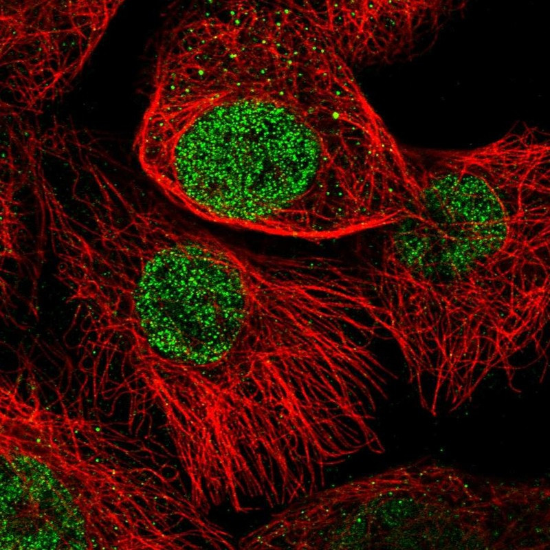 Immunofluorescent staining of human cell line A-431 shows localization to nucleoplasm.