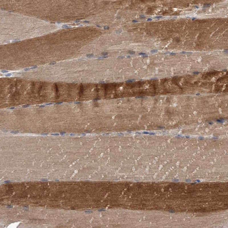 Immunohistochemical staining of human skeletal muscle shows strong cytoplasmic positivity in myocytes.