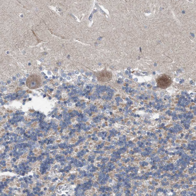 Immunohistochemical staining of human cerebellum shows weak to moderate cytoplasmic positivity in Purkinje cells.