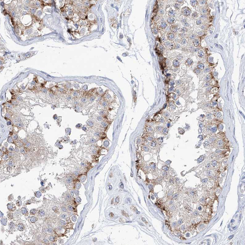 Immunohistochemical staining of human testis shows moderate granular cytoplasmic positivity in spermatogonia.