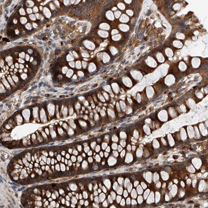 Immunohistochemical staining of human colon shows strong cytoplasmic positivity in glandular cells.