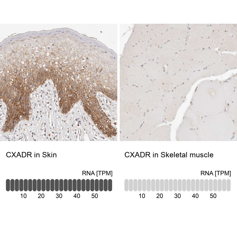 Immunohistochemistry analysis in human skin and skeletal muscle tissues using HPA030411 antibody. Corresponding CXADR RNA-seq data are presented for the same tissues.