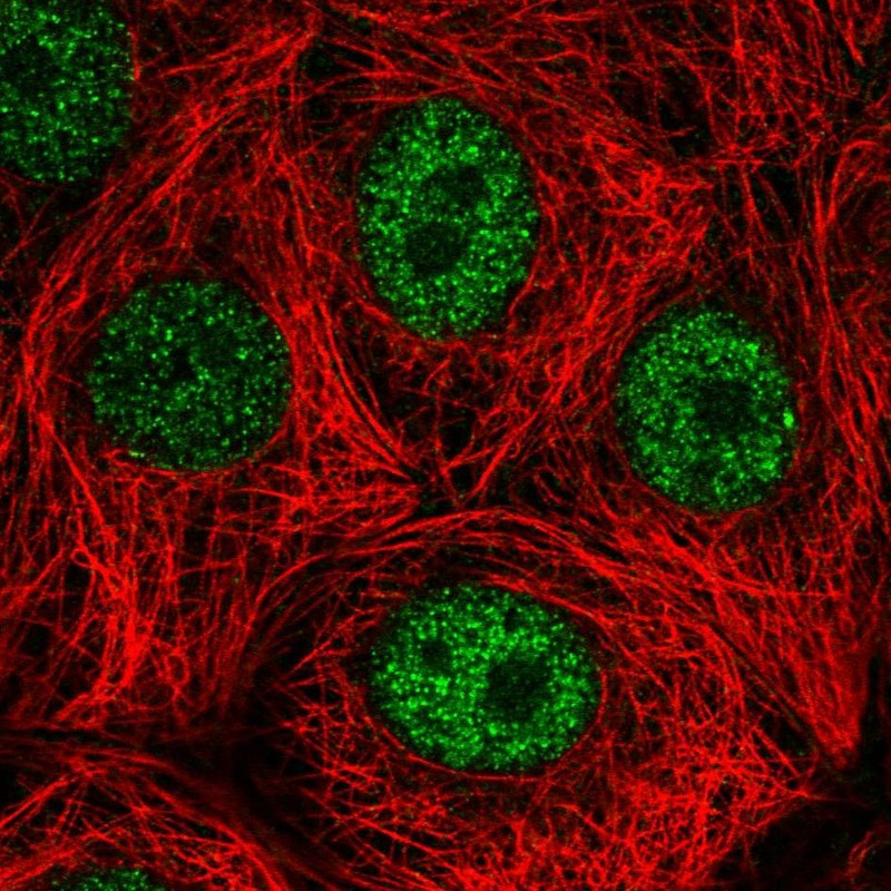 Immunofluorescent staining of human cell line MCF7 shows localization to nucleoplasm.