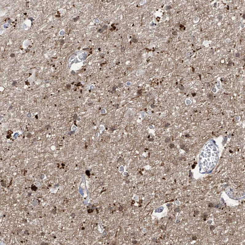 Immunohistochemical staining of human cerebral cortex shows strong cytoplasmic granular positivity in neurons.