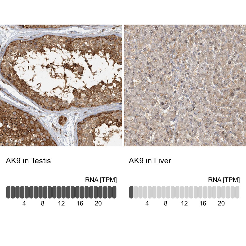 Immunohistochemistry analysis in human testis and liver tissues using Anti-AK9 antibody. Corresponding AK9 RNA-seq data are presented for the same tissues.