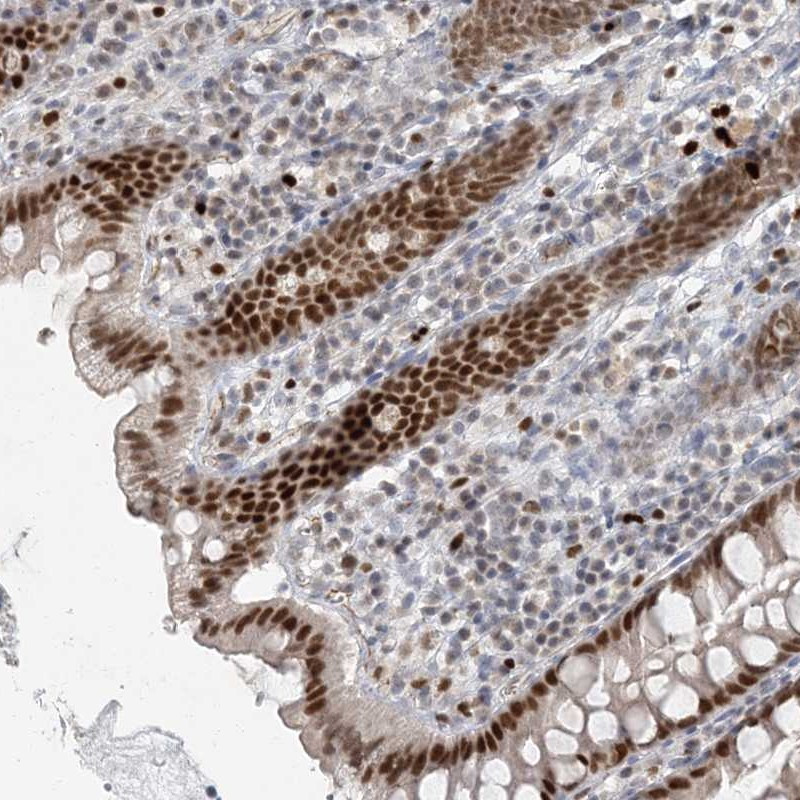 Immunohistochemical staining of human colon shows strong nuclear positivity in glandular cells.