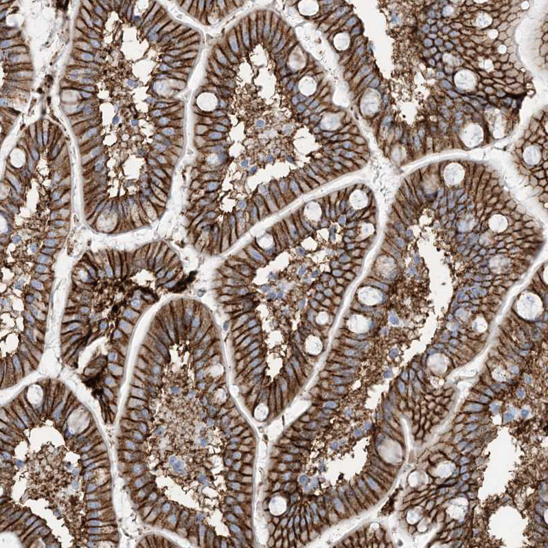 Immunohistochemical staining of human small intestine shows strong membranous positivity in glandular cells.