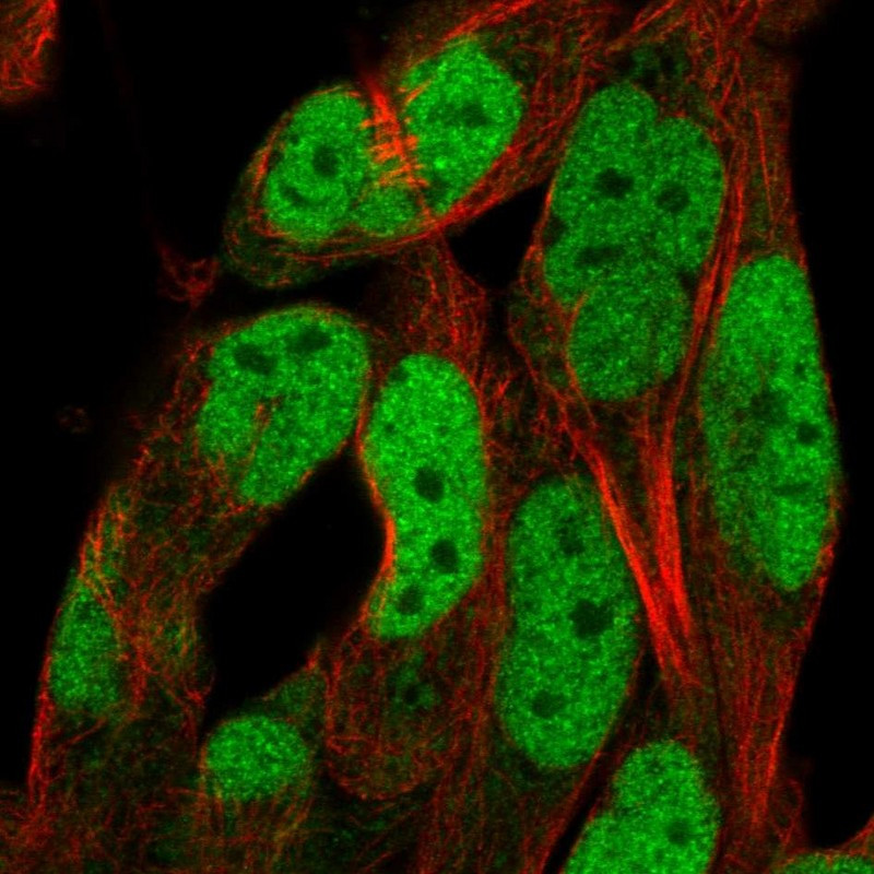 Immunofluorescent staining of human cell line RH-30 shows localization to nucleoplasm.
