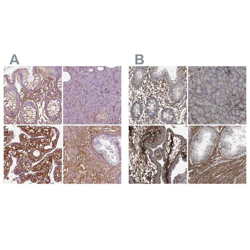 Immunohistochemical staining of human gastrointestinal, pancreas, placenta and prostate using Anti-COL6A2 antibody HPA030920 (A) shows similar protein distribution across tissues to independent antibody HPA007029 (B).