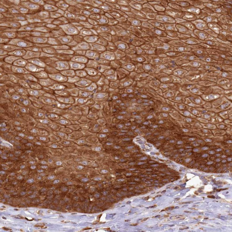 Immunohistochemical staining of human esophagus shows strong cytoplasmic positivity in squamous epithelial cells.