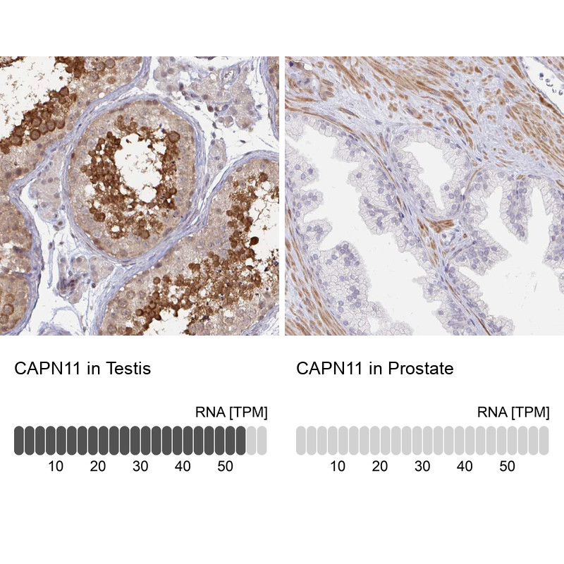Immunohistochemistry analysis in human testis and prostate tissues using Anti-CAPN11 antibody. Corresponding CAPN11 RNA-seq data are presented for the same tissues.