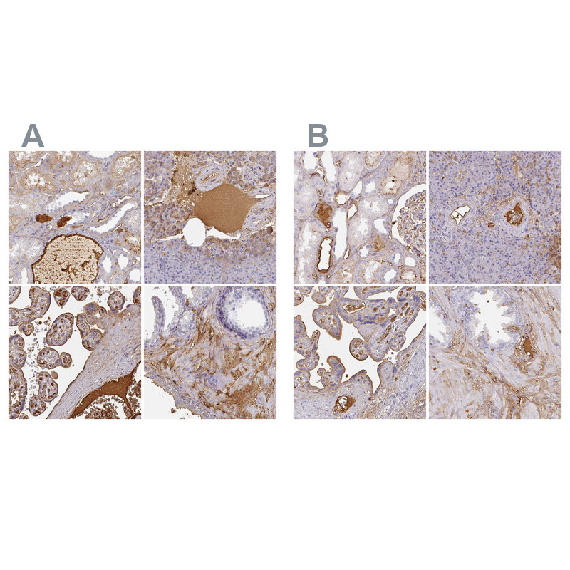 Immunohistochemical staining of human kidney, pancreas, placenta and prostate using Anti-ALB antibody HPA031024 (A) shows similar protein distribution across tissues to independent antibody HPA031025 (B).