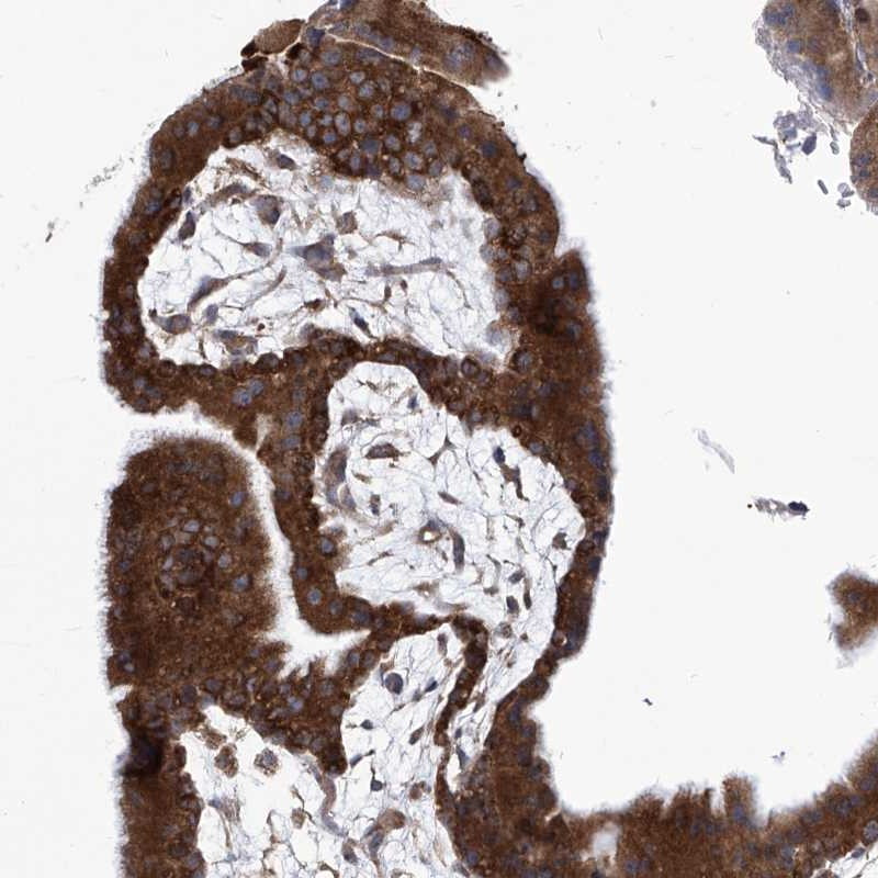 Immunohistochemical staining of human placenta shows strong cytoplasmic positivity in trophoblastic cells.