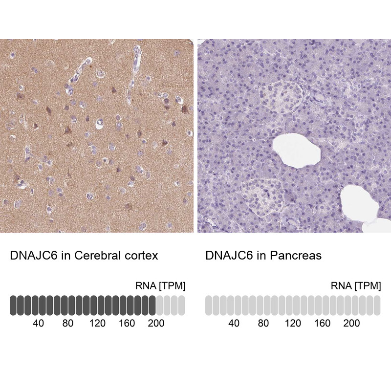 Immunohistochemistry analysis in human cerebral cortex and pancreas tissues using Anti-DNAJC6 antibody. Corresponding DNAJC6 RNA-seq data are presented for the same tissues.